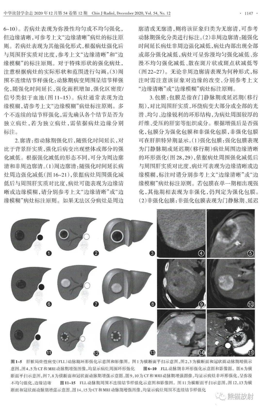规范与共识丨肝脏局灶性病变CT和MRI标注专家共识(2020)_分类