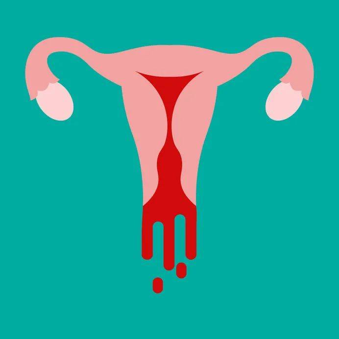 有些女性50岁以后阴道不规则出血滴滴嗒嗒,认为这没什么问题,更年期