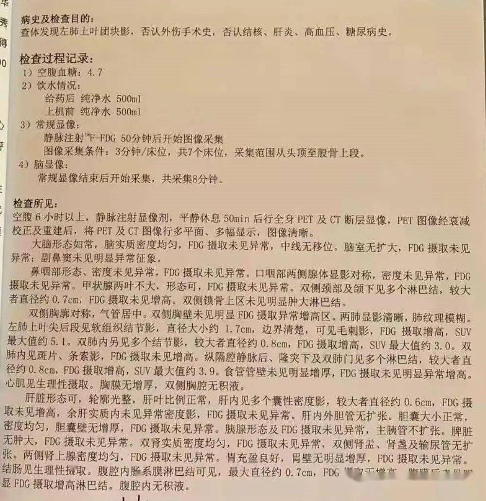 一例误诊为肺癌病例的医生反思