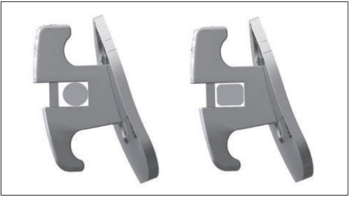 自锁托槽力学特点与牙齿位置的精确控制——张端强主任医师