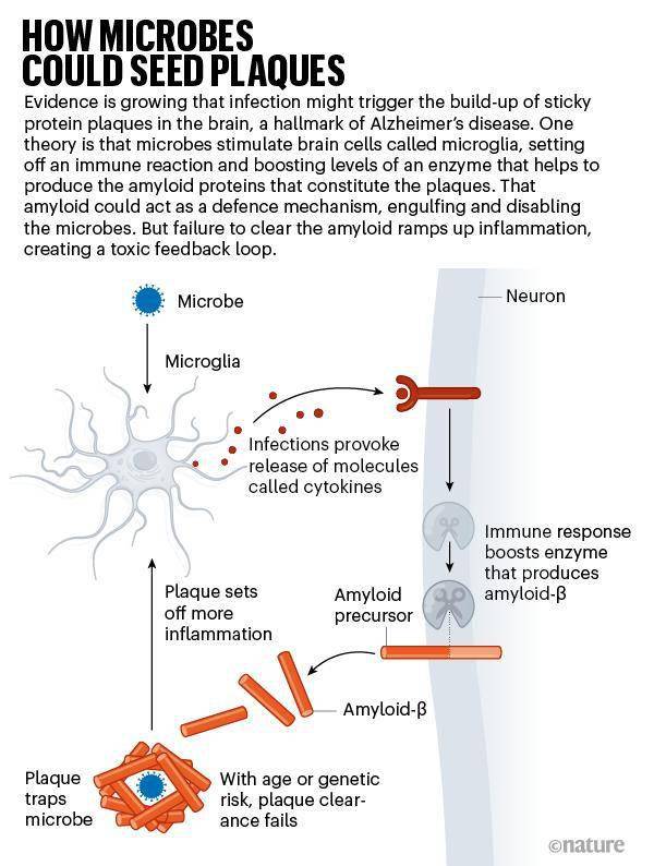 nature阿兹海默症的罪魁祸首竟然是感染