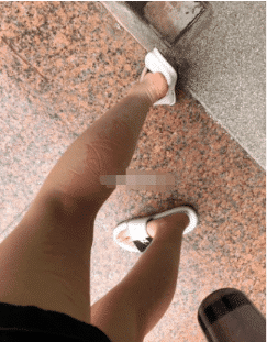 屁股沟里长出一朵金针菇,场面一度十分尴尬,哈哈哈辣眼睛