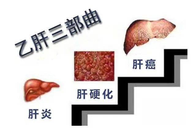 乙肝病毒潜伏期有多长一旦出现这些症状就要注意了