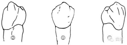 各个牙体雕刻之基本形态要求