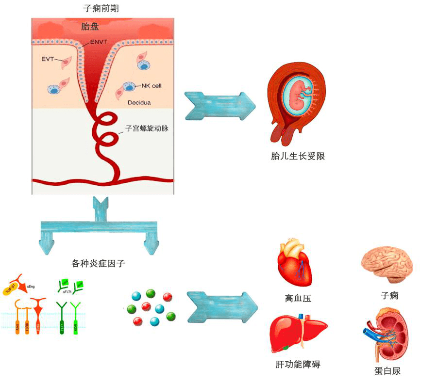 孕產課堂懷孕期間血壓稍高是得了妊娠高血壓嗎