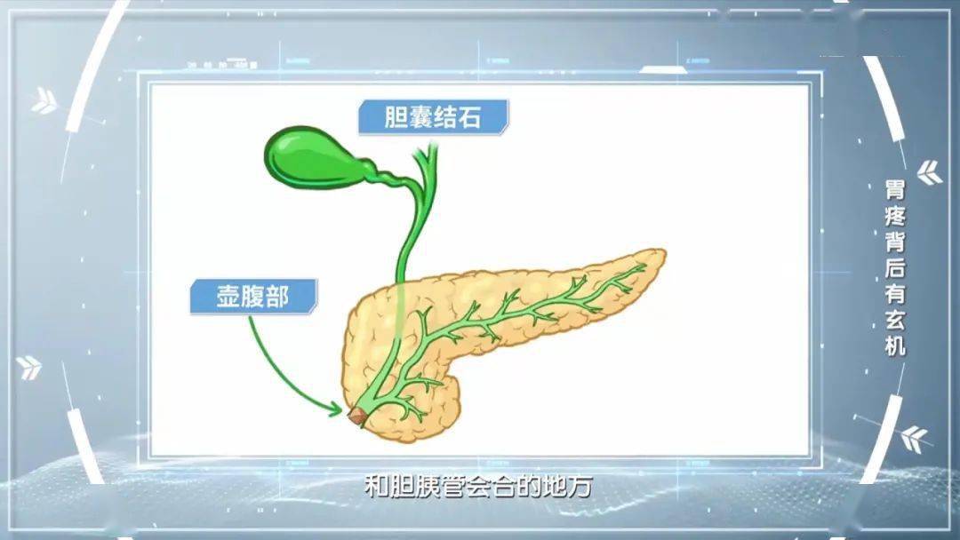 胰管解剖图片