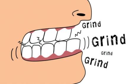 磨牙症或与牙周炎密切相关?| 最近的研究