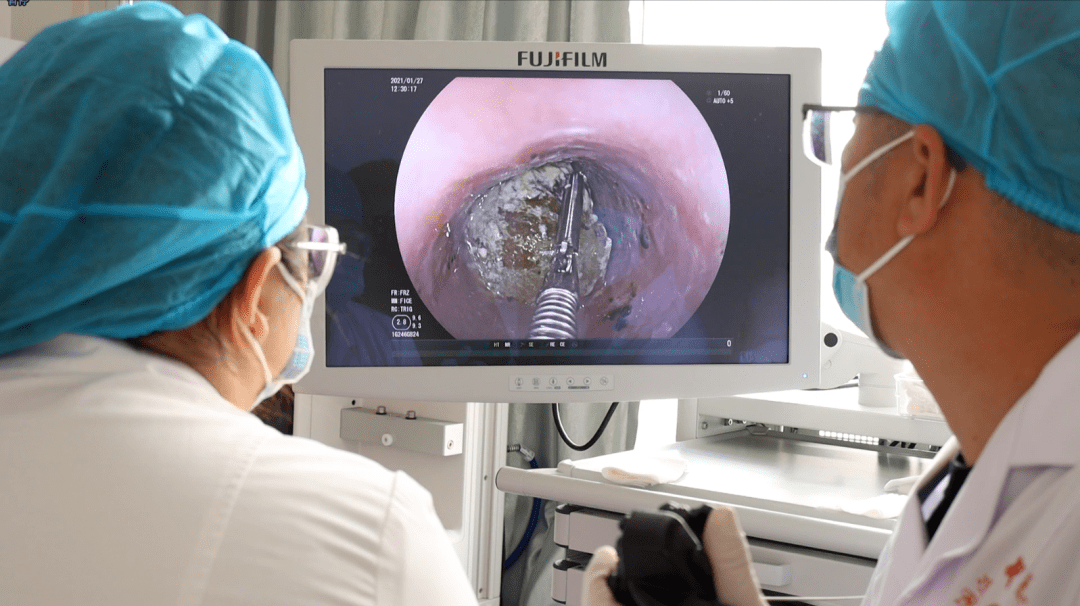 内镜探查取异物老人化险为夷