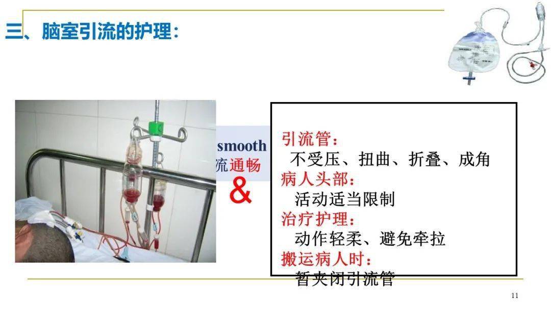 【ppt】脑室引流管的护理