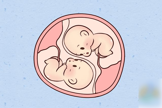 怀孕双胞胎一个月图图片
