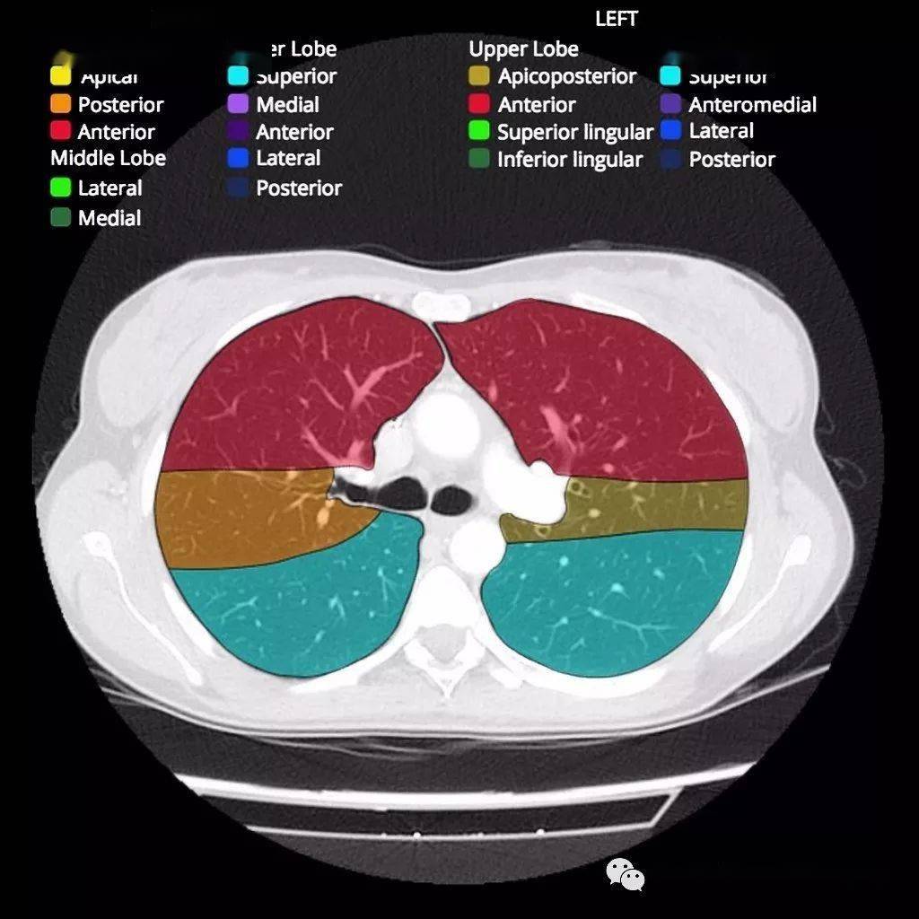 ct肺段解剖(图)