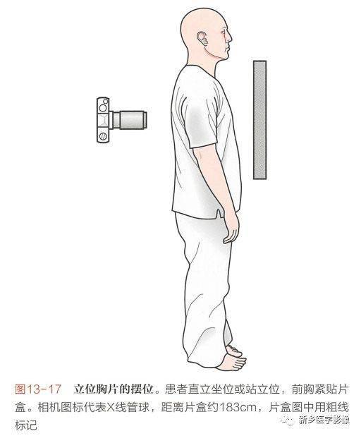 影像科遇到急腹症如何摆位如何读片总结4个体位仰卧俯卧立位腹平片立