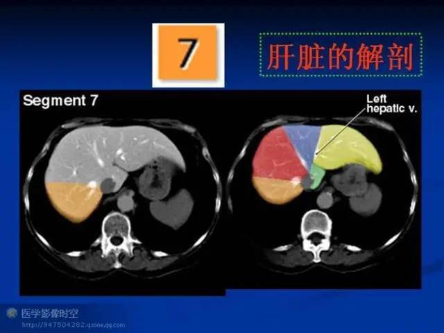 最全肝段解剖图解_静脉