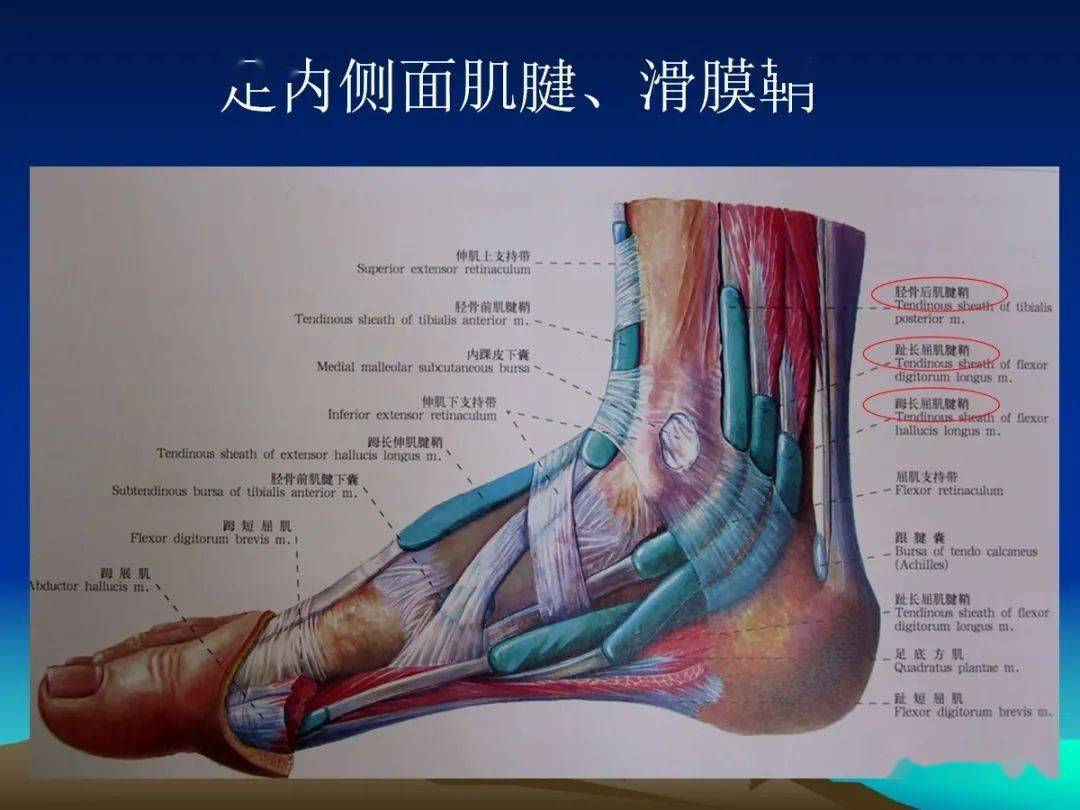 踝关节韧带或其他软组织损伤可能会导致较严重的创伤性骨关节炎,骨质