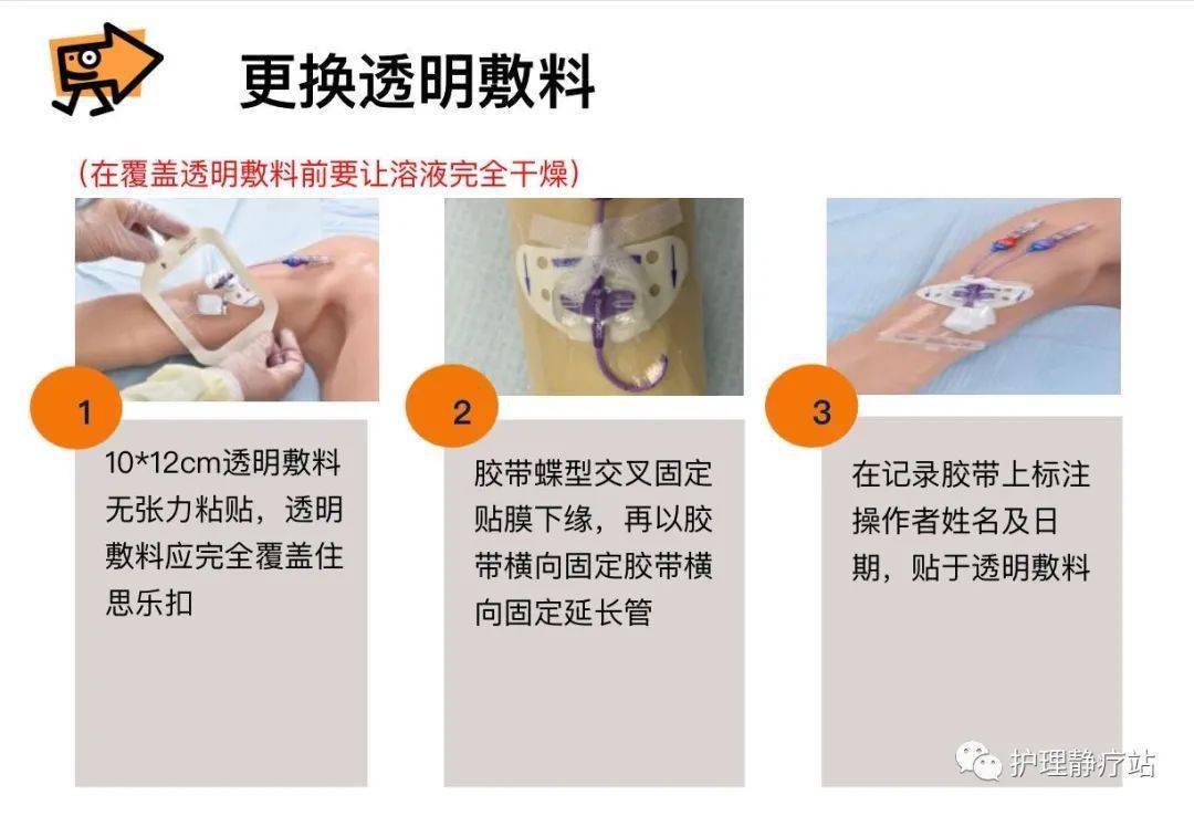 正压封管picc维护的重要步骤你做对了吗