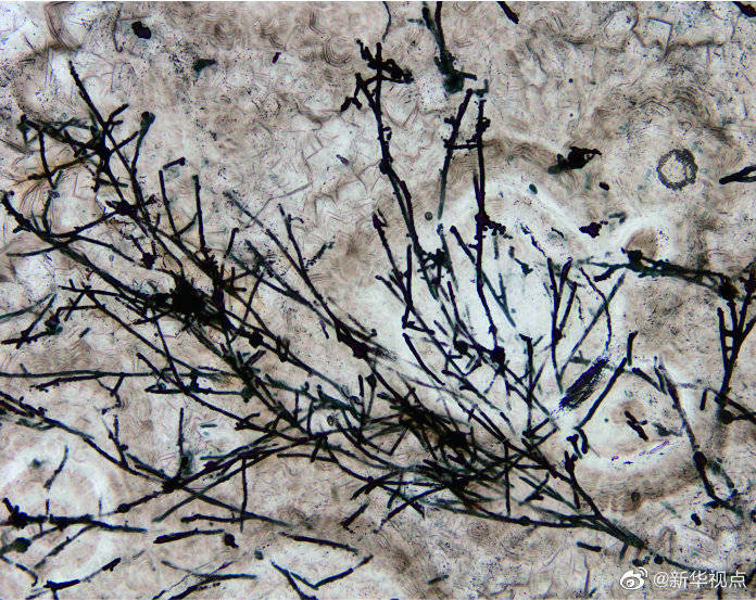研究|科学家发现6.3亿年前的蘑菇祖先