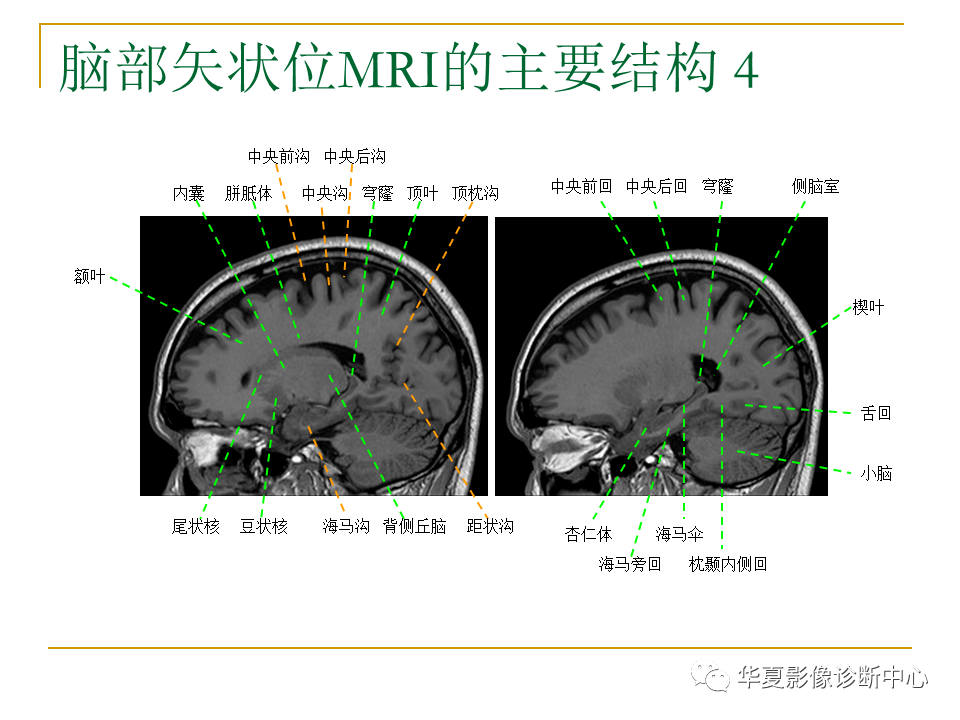 腦mri必備丨最詳細的腦mri解剖