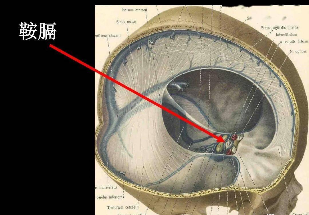 高清解剖 脑室/脑池/脑膜