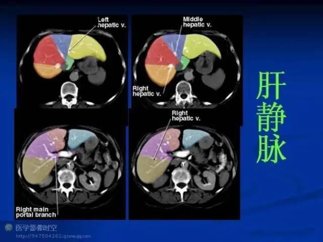 影像必备丨最全肝段解剖图解