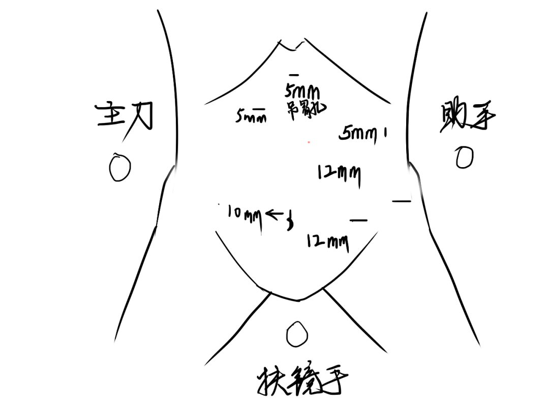 脾什么什么切成语_成语故事简笔画(2)