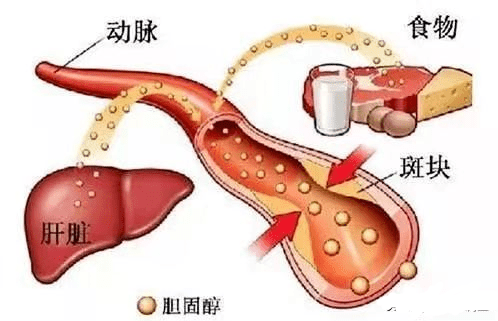 血脂怎样查 c81bde932f144405b0896fdd3456418f.png