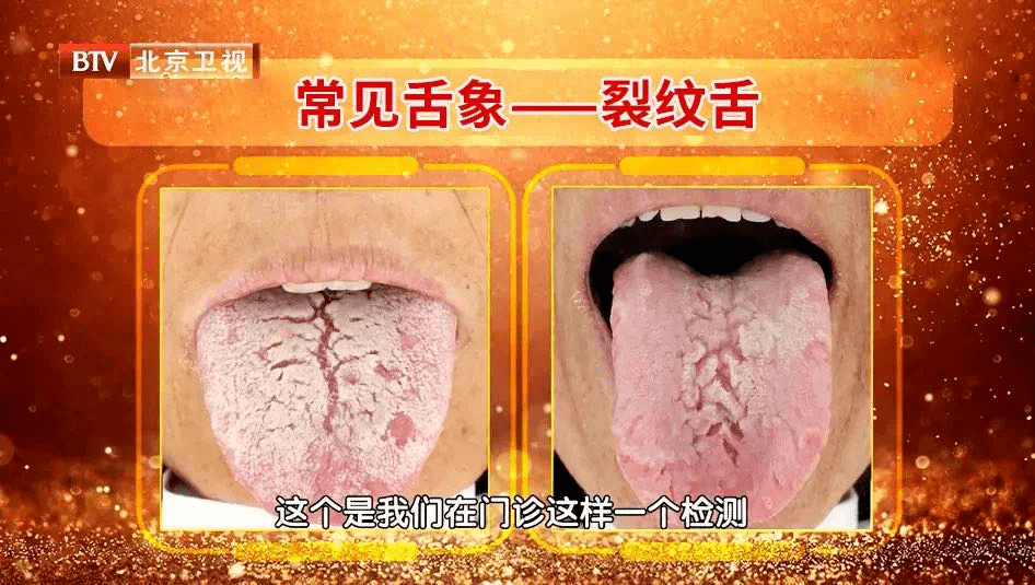 疾病来临前身体这些地方会露出马脚再小的变化也别忽视赶紧对照自查