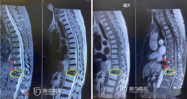 骨痛老不好？这次不是骨转移，而是这个原因_手机搜狐网