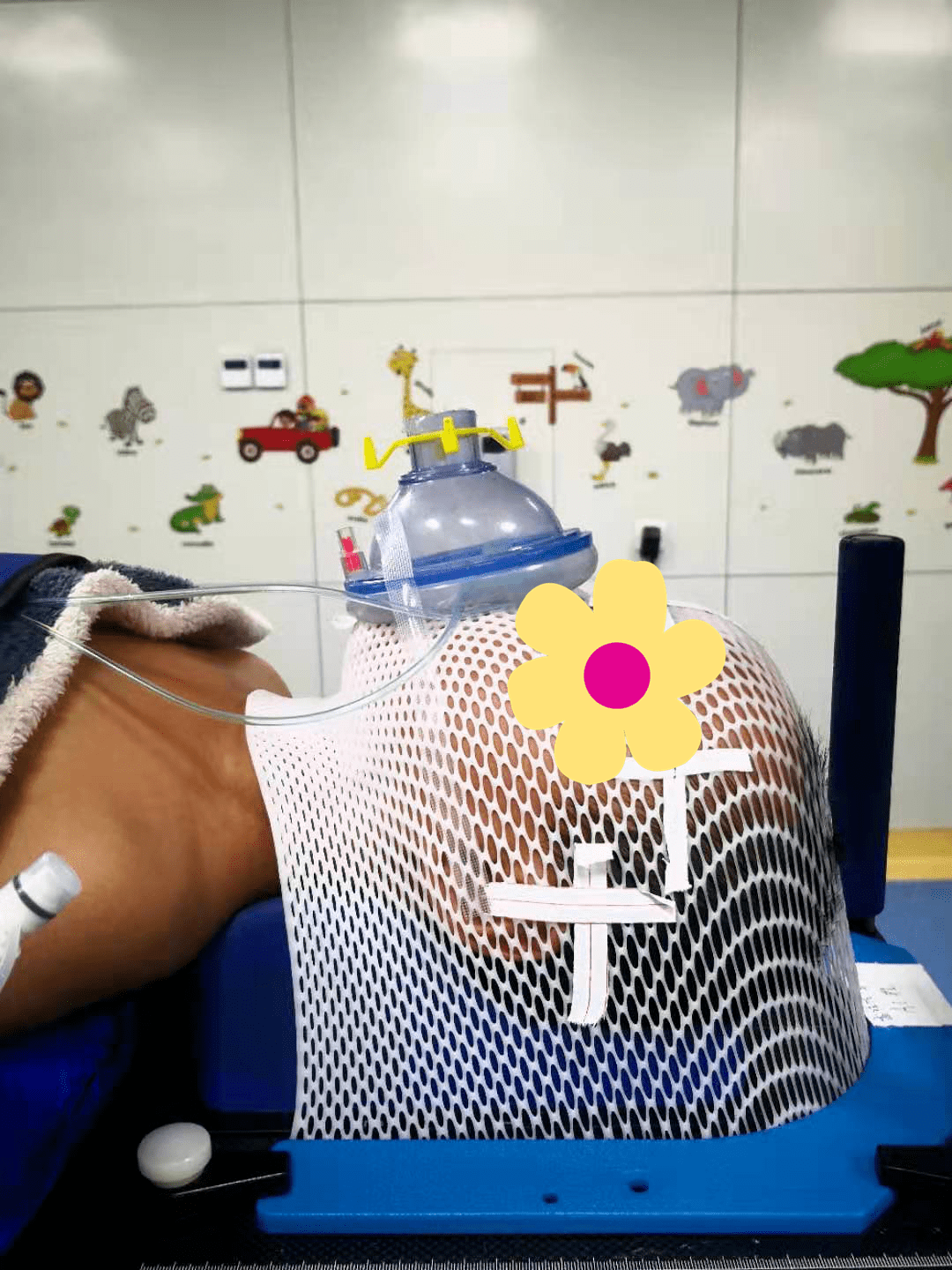 前沿了解没有眼泪的放疗儿童麻醉下放疗