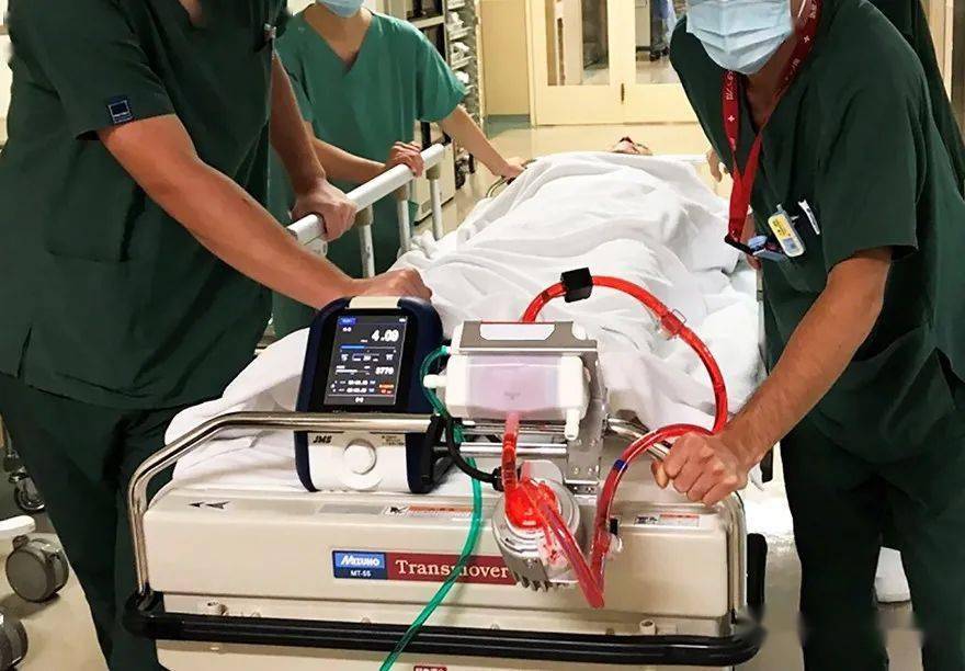 人工心肺装置设计介绍