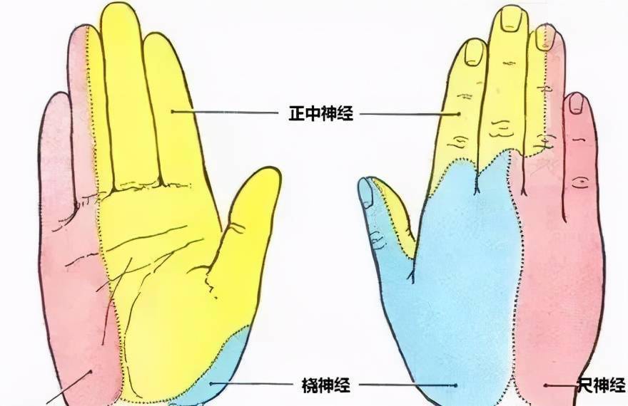 对号入座!颈椎病导致不同手指麻木,提示不同节段的颈神经受压