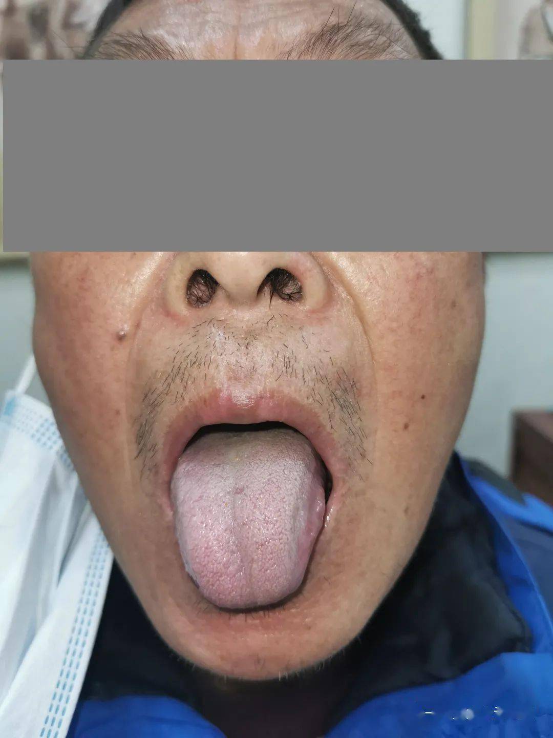 医案辨证论治纸上得门诊教学方躬行