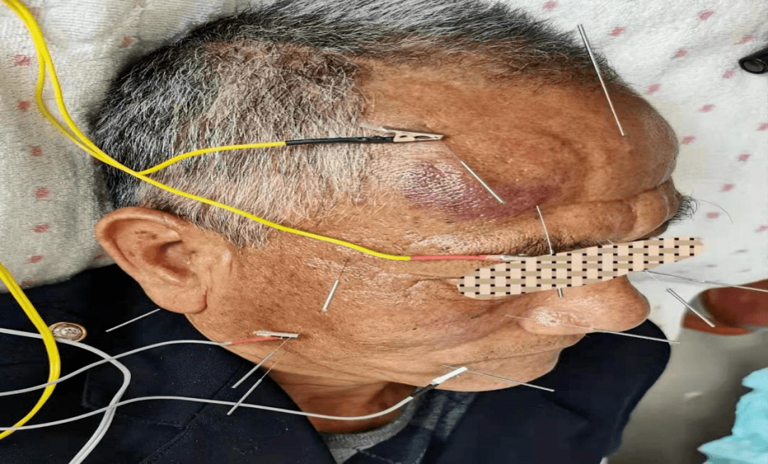 推拿,拔罐,刮痧,小儿推拿,理疗等十几种中医传统治疗项目,可以结合