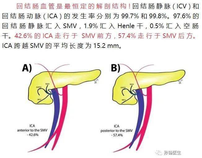 医学笔记|右半结肠的血管变异_解剖