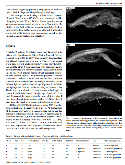 协和眼科研究系列报道睫状体淋巴瘤ubm影像学特点