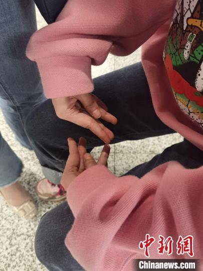 图为患者双手蜷曲,内翻,呈爪型手.受访者供图