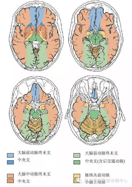 腦血管解剖圖譜詳細標註腦梗死責任血管判定