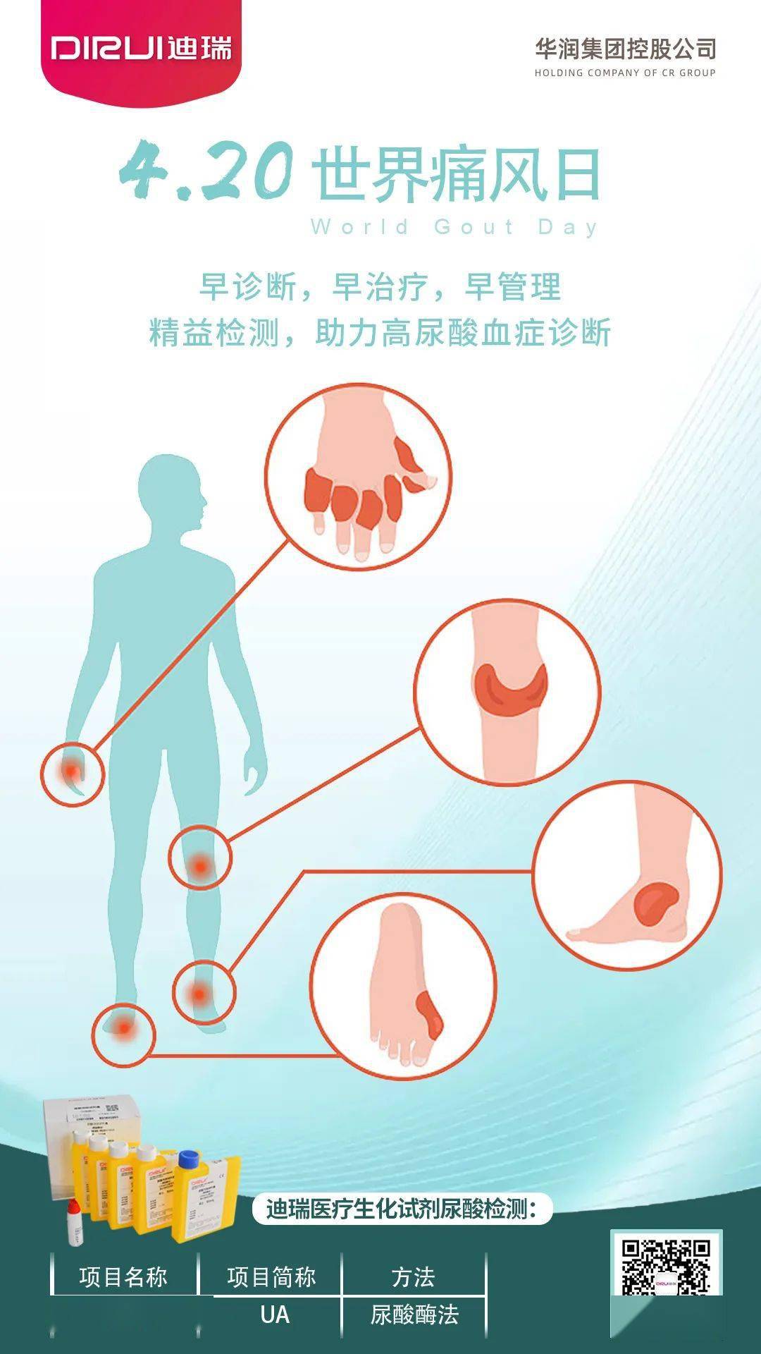 世界痛风日精益检测助力高尿酸血症诊断