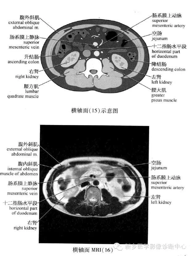 腹部肌肉ct解剖图片