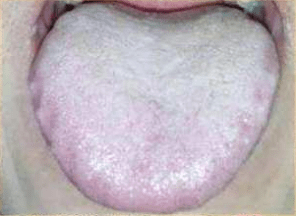 ee0a595ef15a429b9103e5f5d58451eb.png