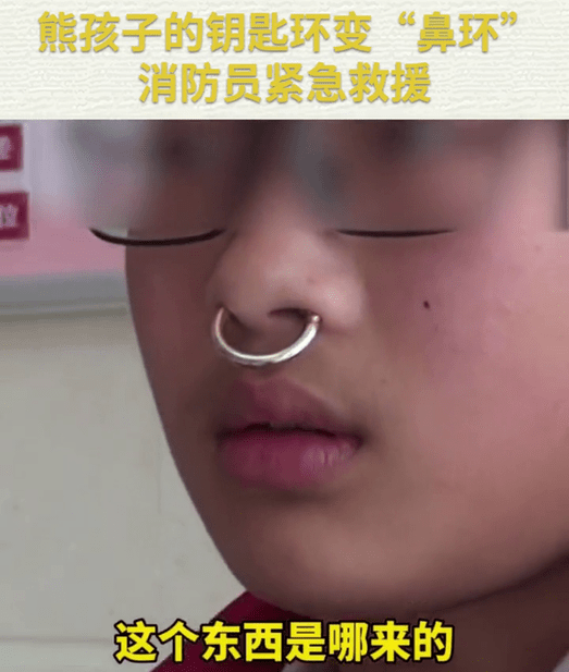 熊孩子把钥匙环变"鼻环"无法摘除,消防员紧急救援