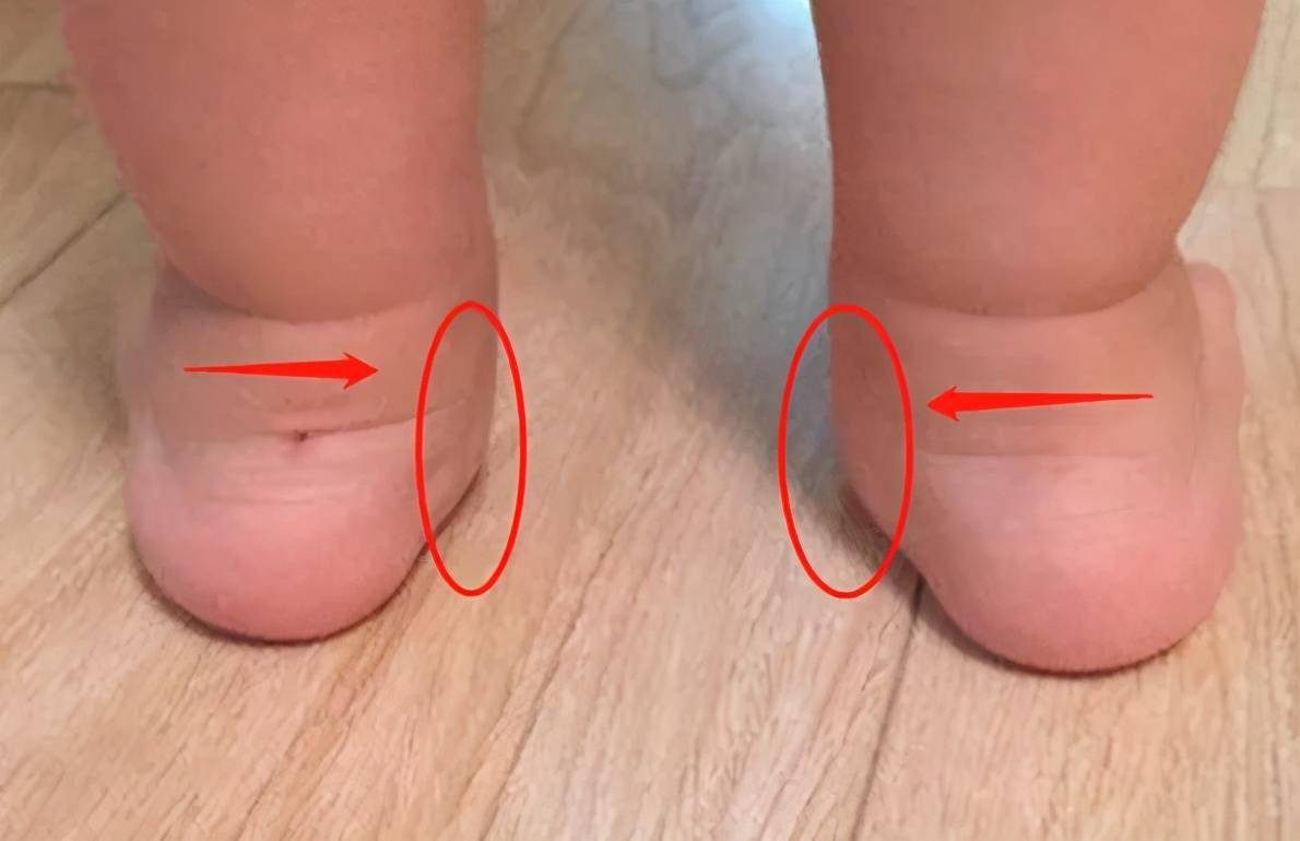宝宝脚踝弯图片图片
