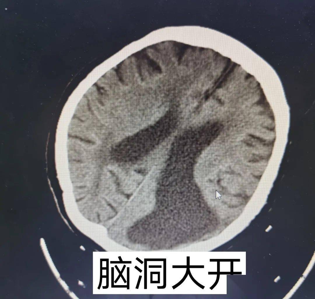 脑洞大开这些表情包居然只有医生才看得懂