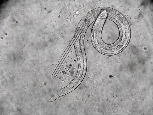 世间生物压力_生物层面的压力源_生物压力有哪些