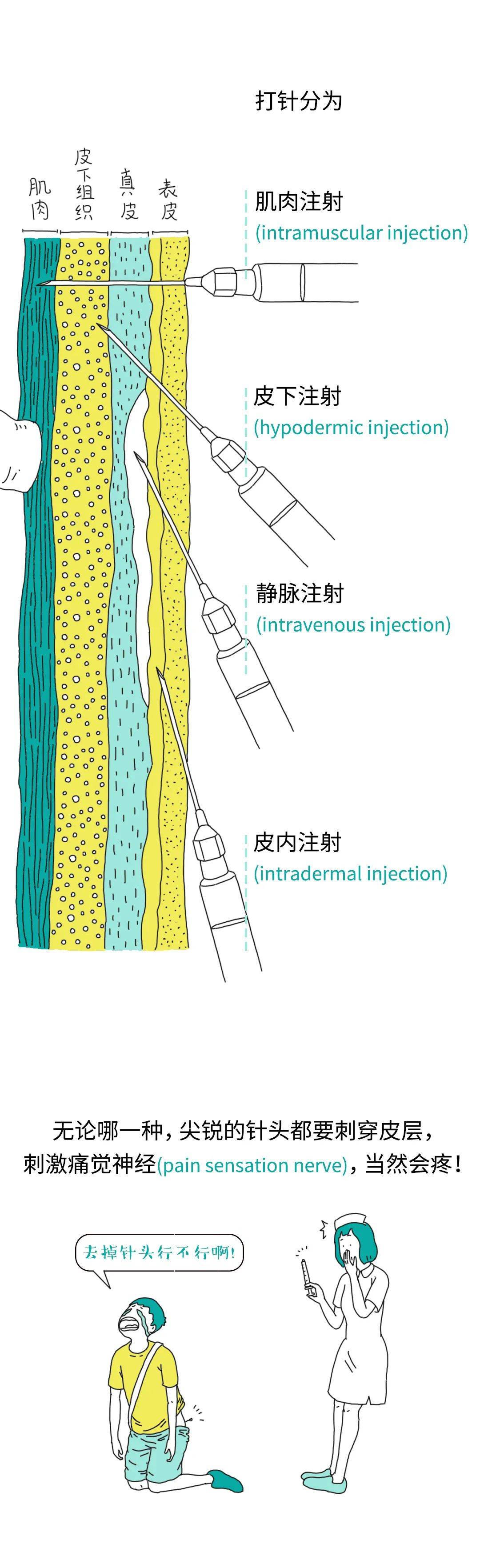 皮质下定位图片图片