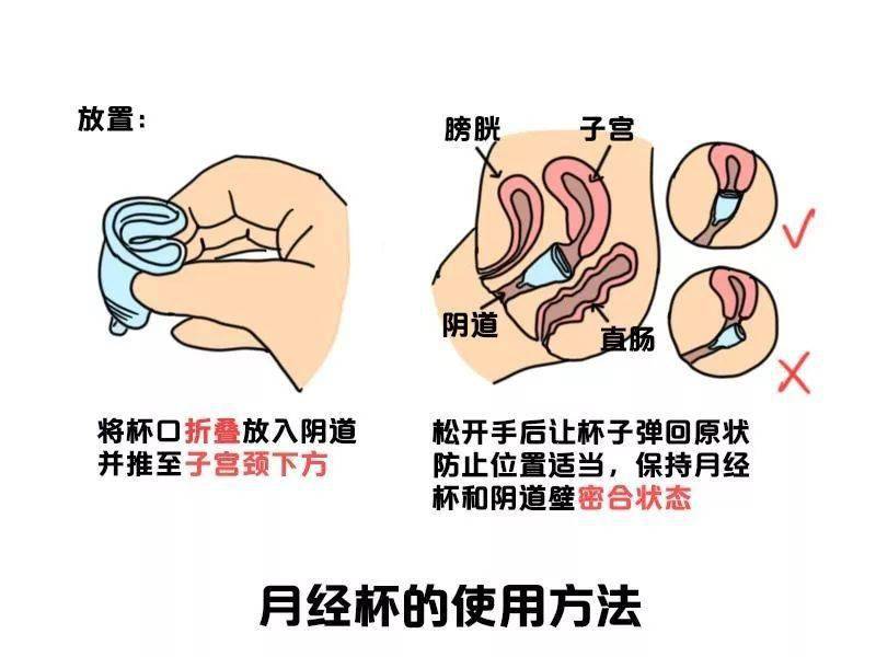 卫生巾卫生棉条月经杯优缺点大比拼哪个才是你的最佳选择