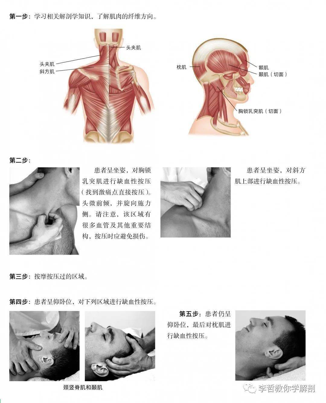 好书推荐 头痛 颈痛 腰背痛 激痛点简明手册 专业与自助处理方法 治疗