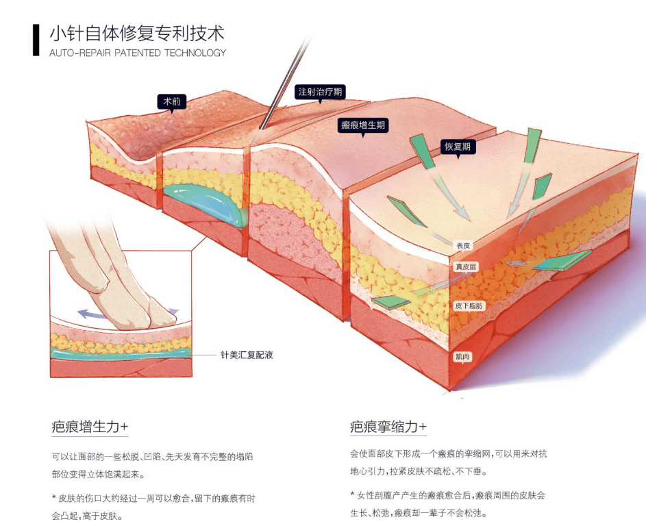 针美汇崔海茹图片