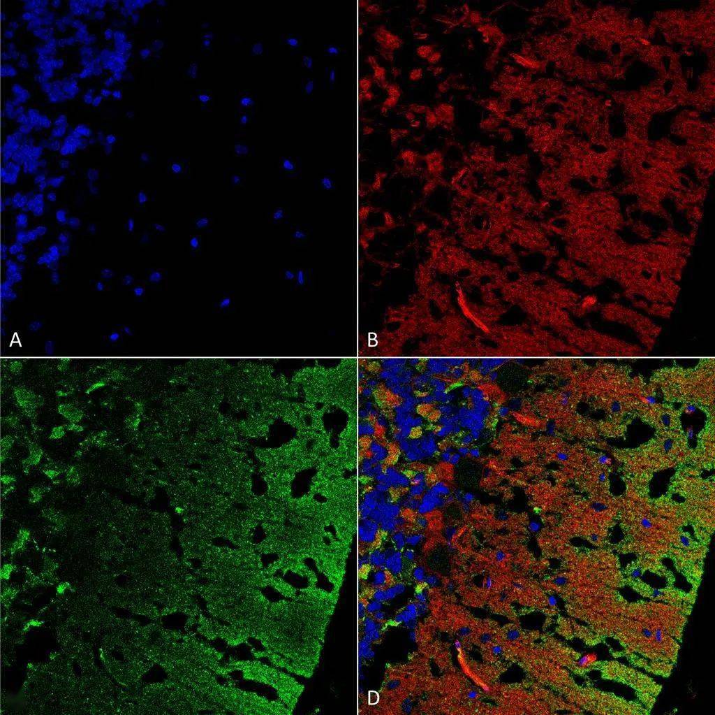 使用小鼠抗 alpha synuclein 单克隆抗体(smc-530)对大鼠小脑的免疫