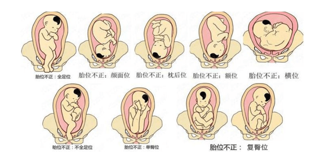 不要频繁抚摸肚子感觉胎儿总是在右侧胎动,准妈妈也不要为安抚宝倍