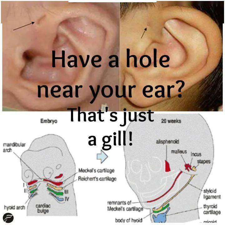 耳什么离腮成语_耳下腮部有肿块是什么(3)